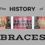 The Evolution of Orthodontics: Trends and Innovations in Lubbock's Dental Scene