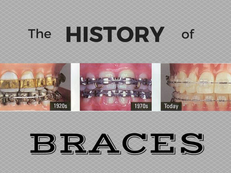 The Evolution of Orthodontics: Trends and Innovations in Lubbock’s Dental Scene